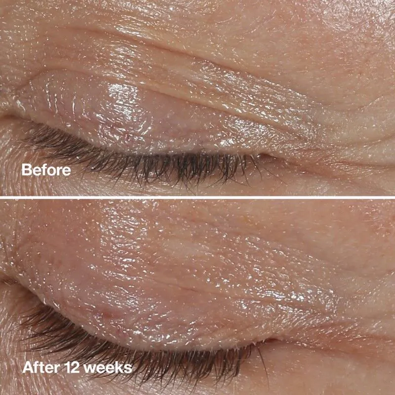 Clinique Smart Clinical Wrinkle Correcting Eye Cream Krem pod oczy