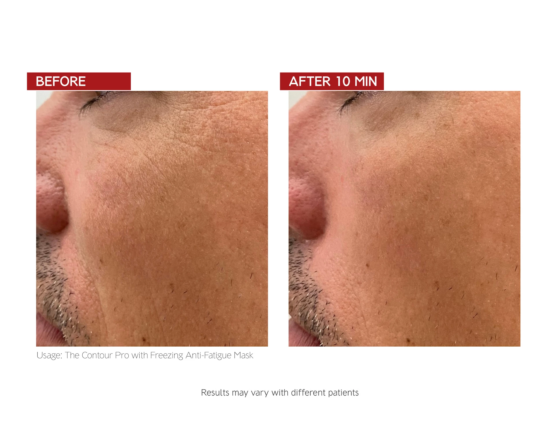 The Contour Pro - Dr. LEVY Elveția