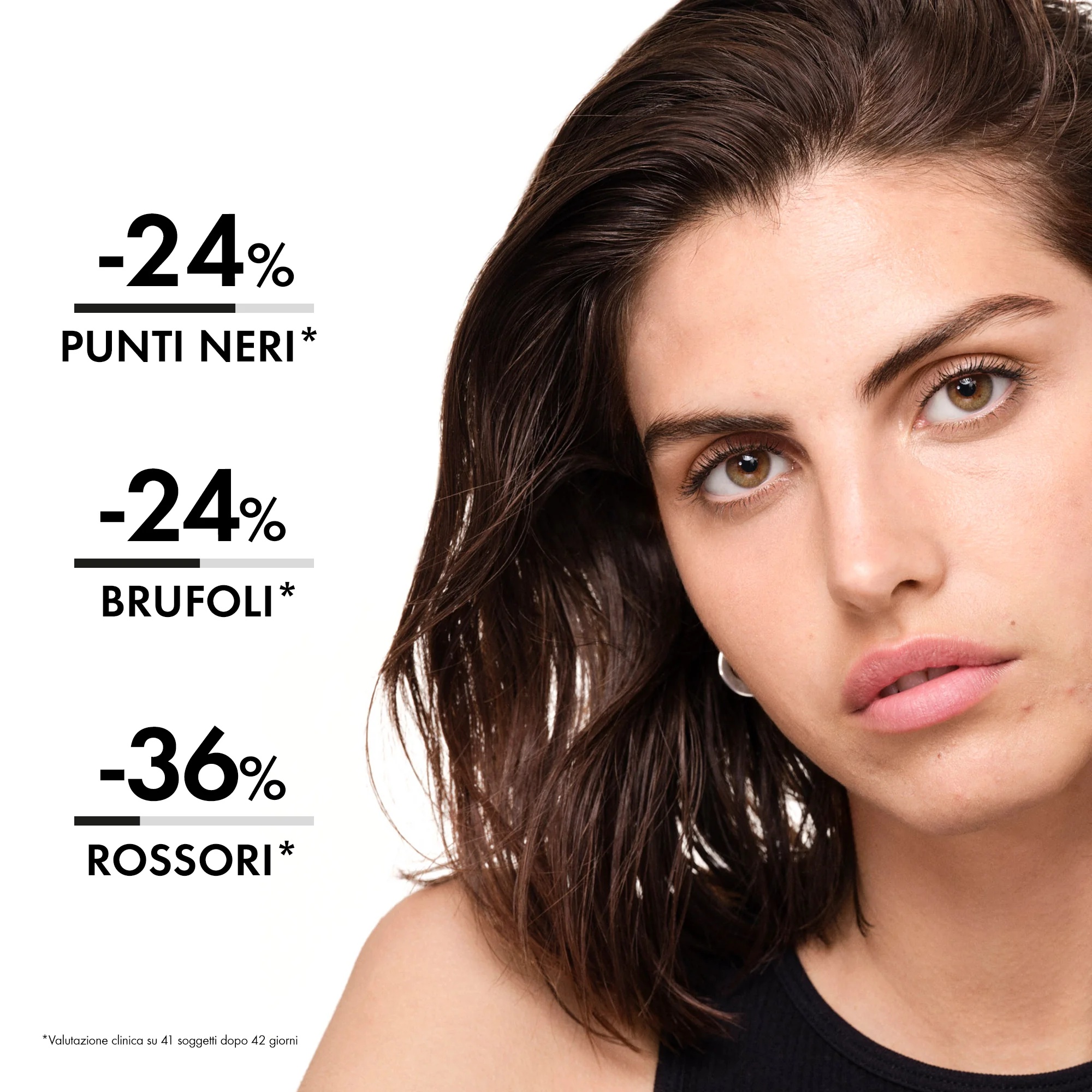 VICHY Normaderm Probio-Bha Serum tegen imperfecties 30 ml