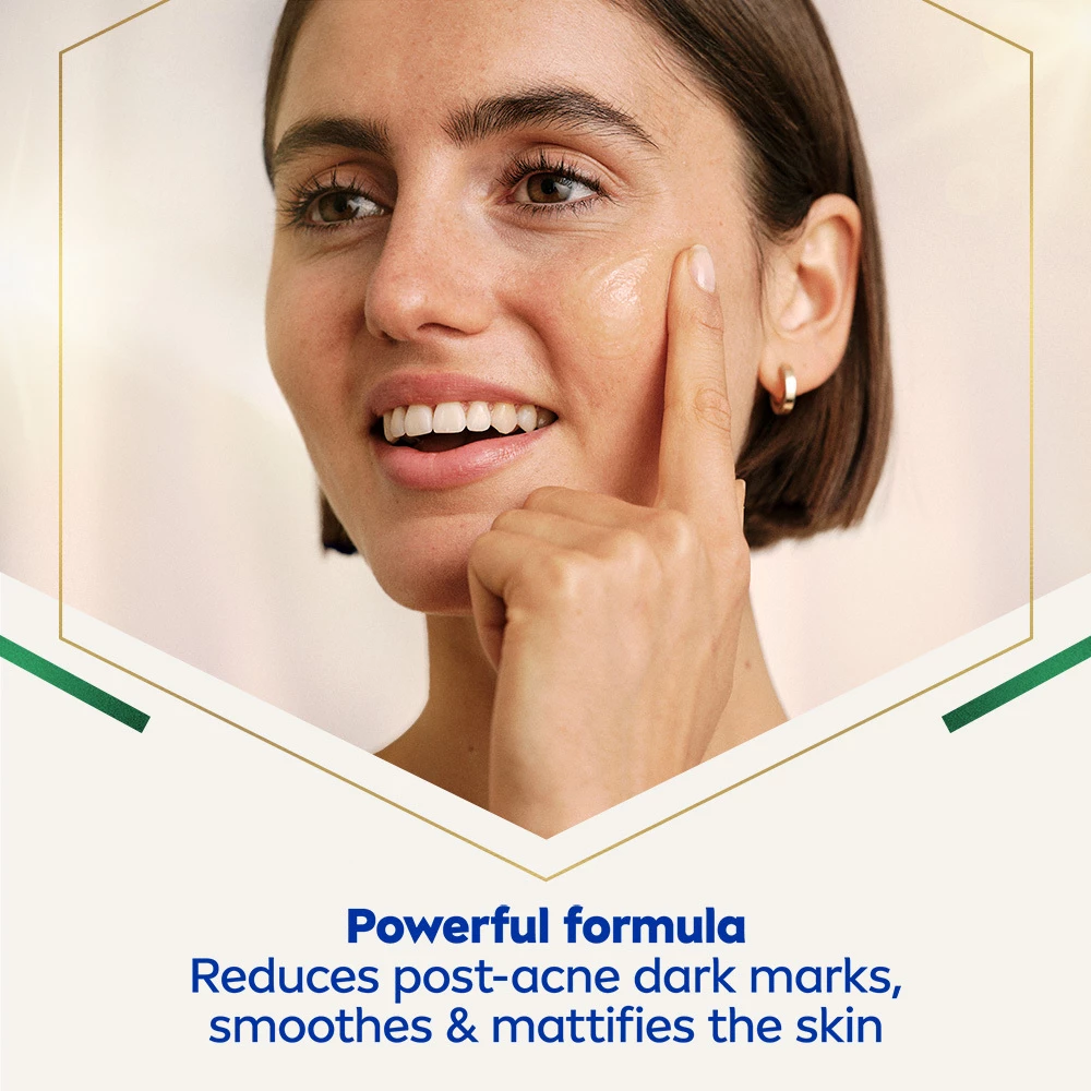 Luminous630 Pattanás utáni szérum 30 ml - NIVEA