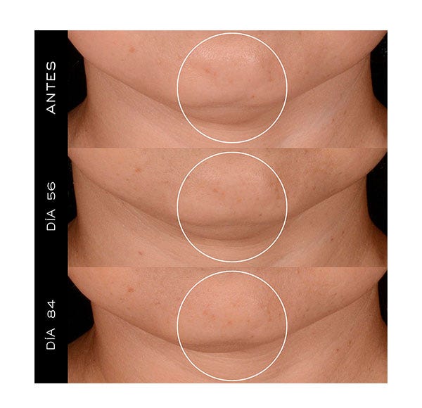 Rénergie HPN 300-Peptide krém| 1 db
