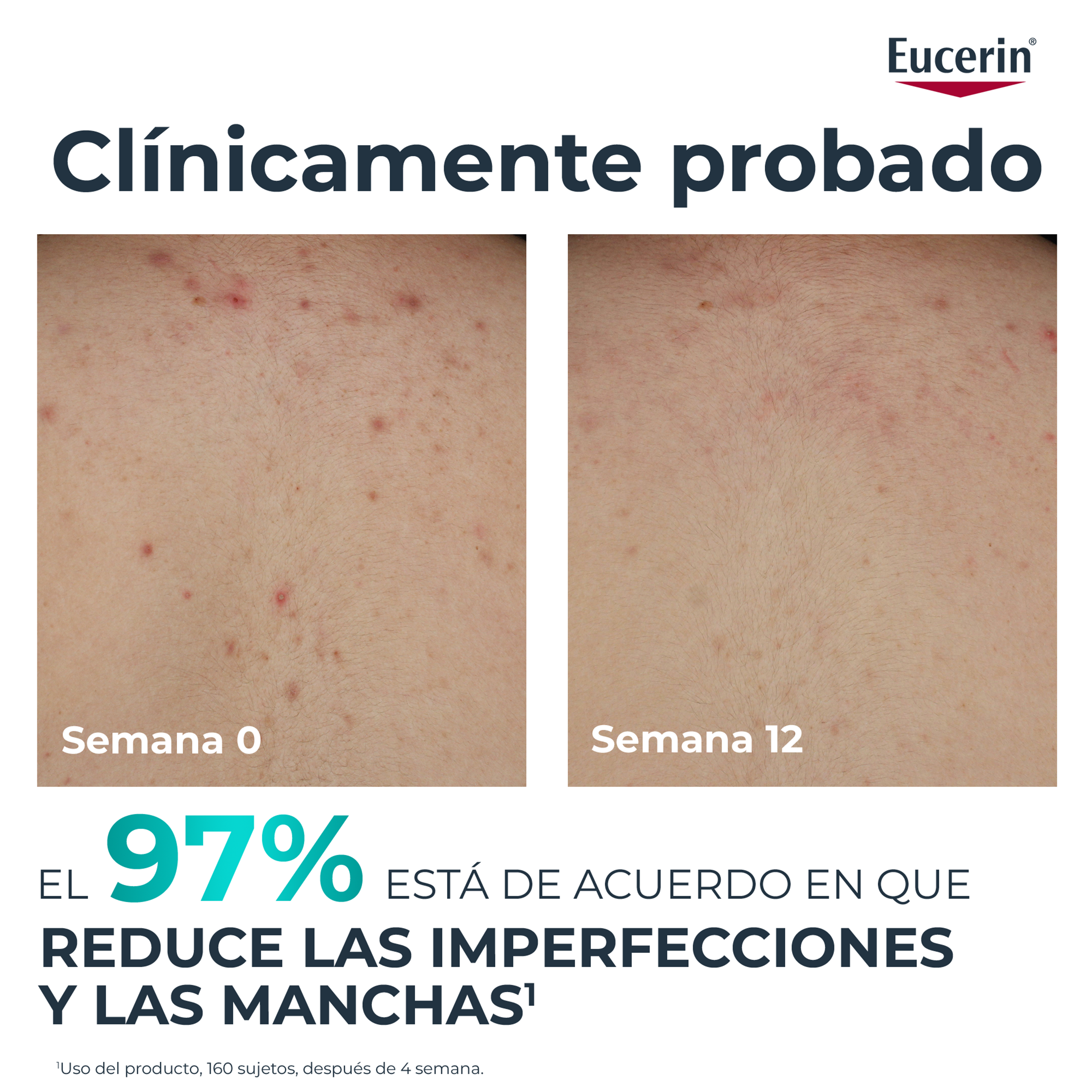 DermoPure Clinical Correction крема за тело Дермокозметика за тело