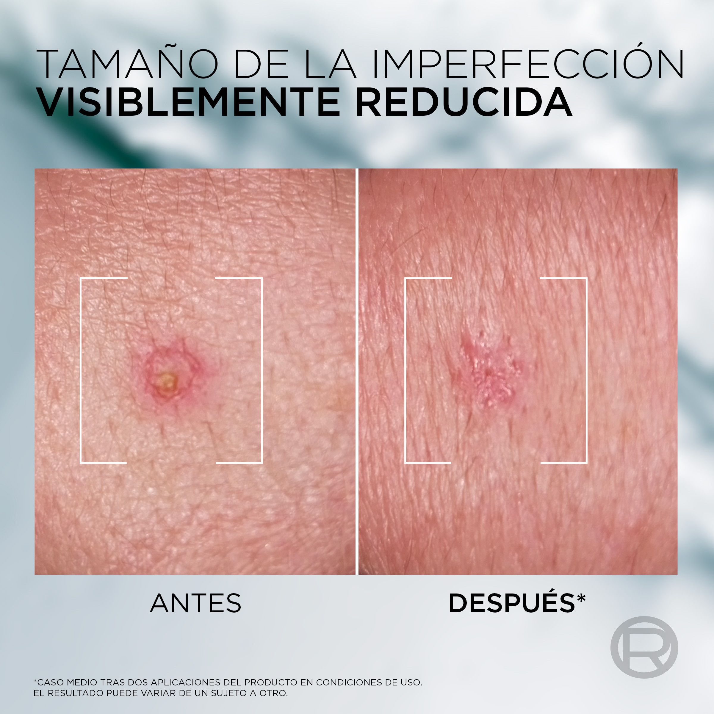 Men Expert Derma Control SOS pasta za prištiće, otopina protiv nepravilnosti s niacinamidom i glikolnom kiselinom Kozmetika za lice