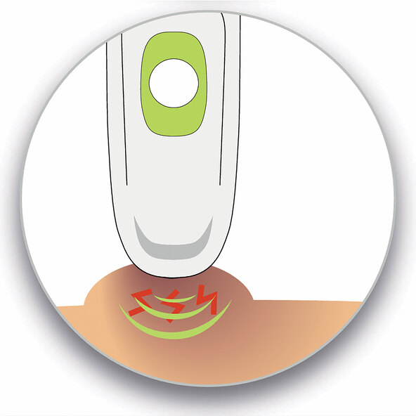 Vindecător pentru mușcături de insecte ISH702
