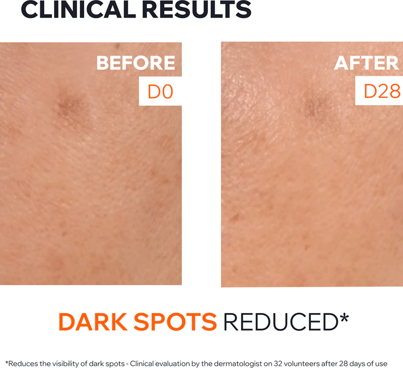 Uriage Dépiderm Anti-Dark Spot Brightening Booster Serum: een serum voor het verminderen van pigmentvlekken met een oplichtend effect.