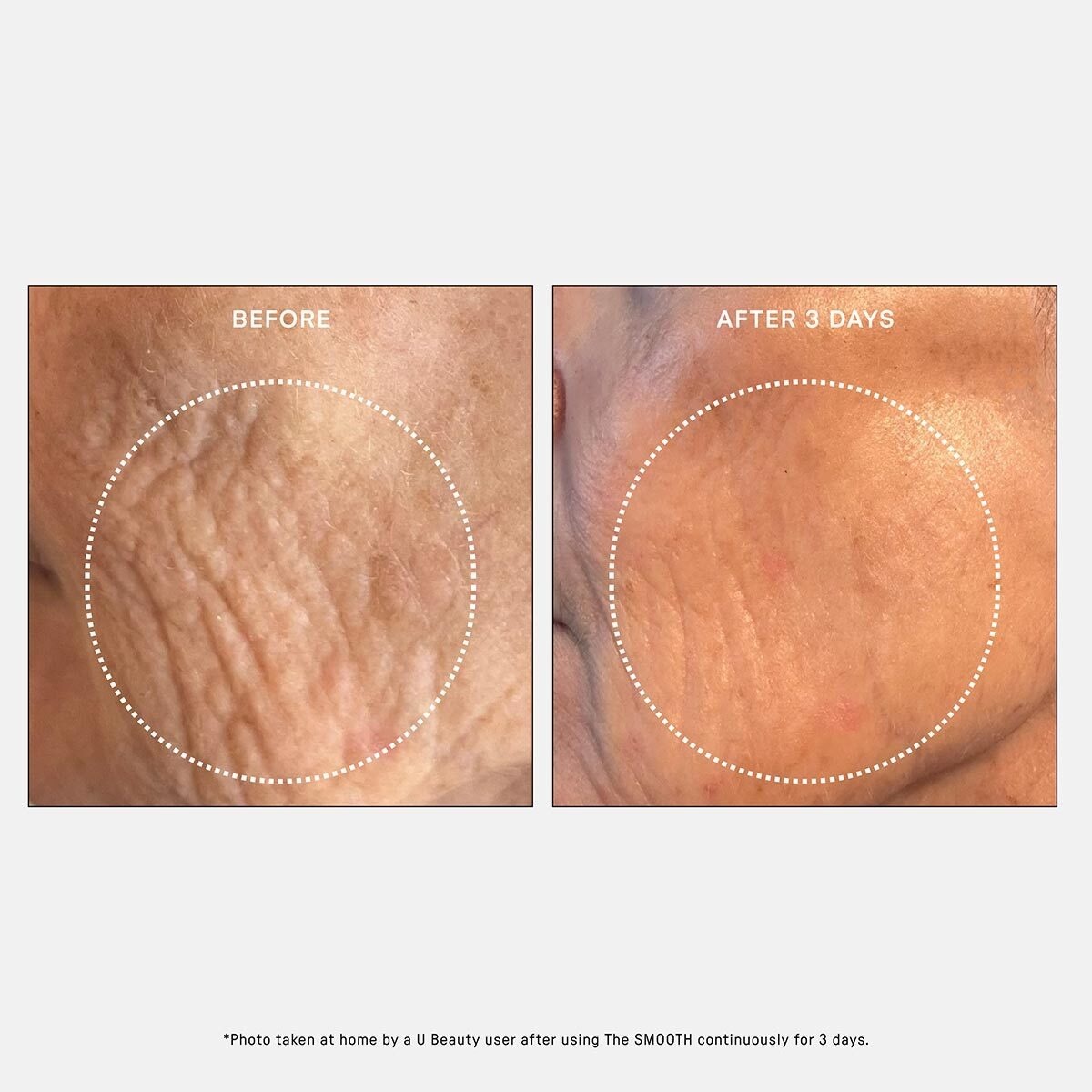 BEAUTY pretnovecošanās serums The SMOOTH Dynamic Wrinkle Defense Serum - 15 ml