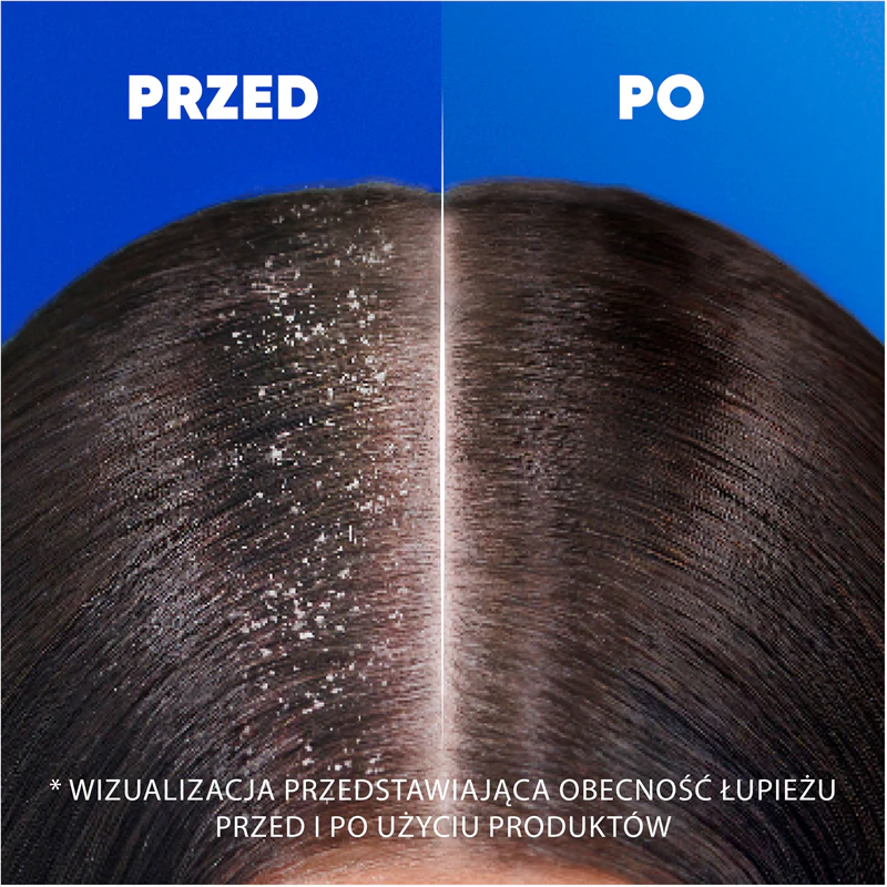 Shampoo Anticaspa Head & Shoulders Suave e Sedoso