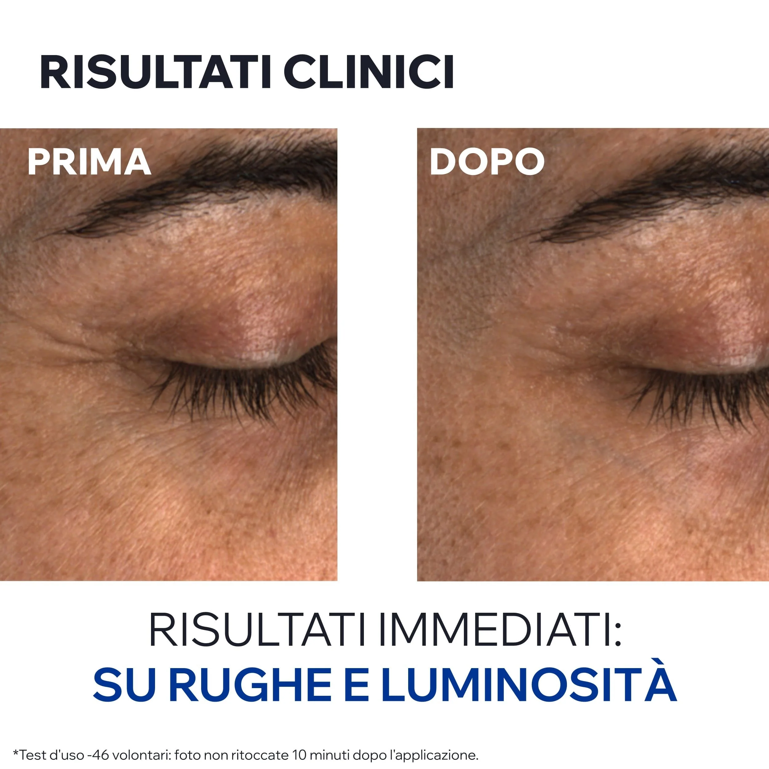 AGE ABSOLU Balsamo Contorno Occhi Perfezionatore e Ridensificante - Contorno occhi antirughe, Tratt.anti borse e occhiaie