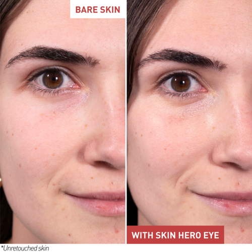 Skin Hero Eye