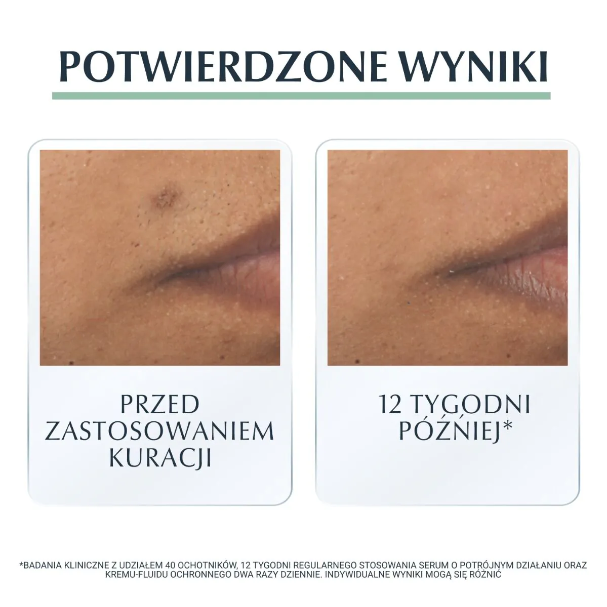 Eucerin Dermopure serum o Potrójnym Działaniu