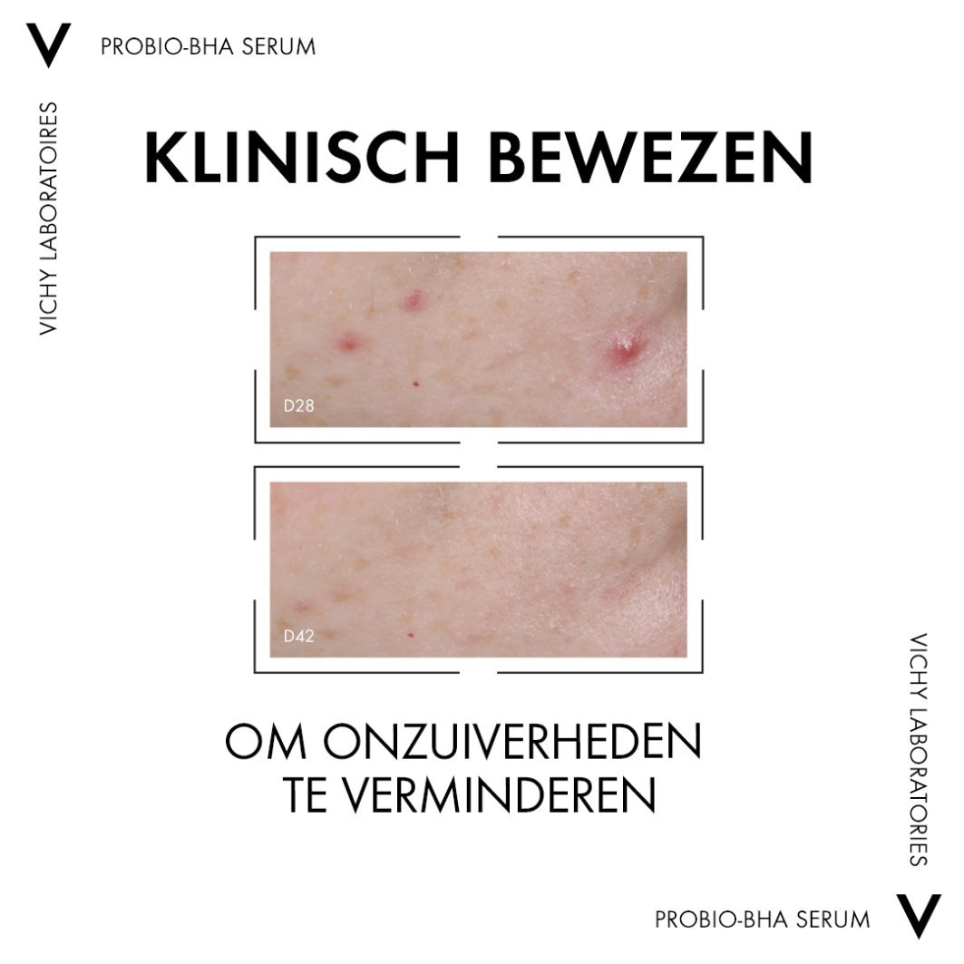 Vichy Anti-Blemish Care Normaderm Probio-BHA Serum voor Puistjes - 30 ml