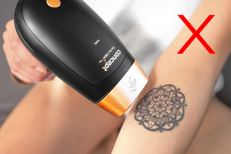 Depilador IPL Concept Perfect Skin Pro Anti-Age IL5020 para corpo, rosto, área do biquíni e axilas.
