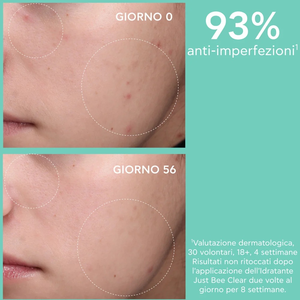 APIVITA Apivita Just Bee Clear Hydra 40 ml ματ ενυδατική κρέμα
