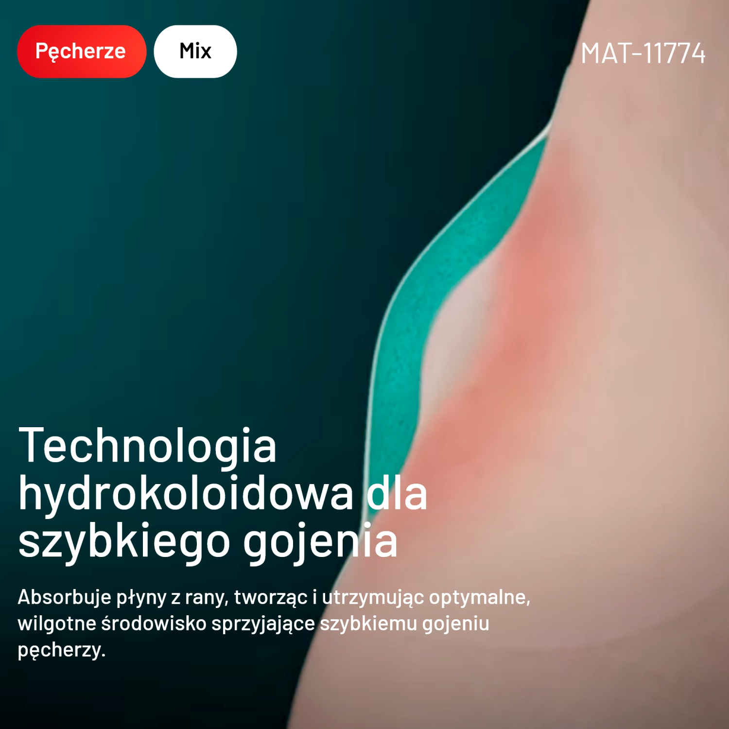 Compeed