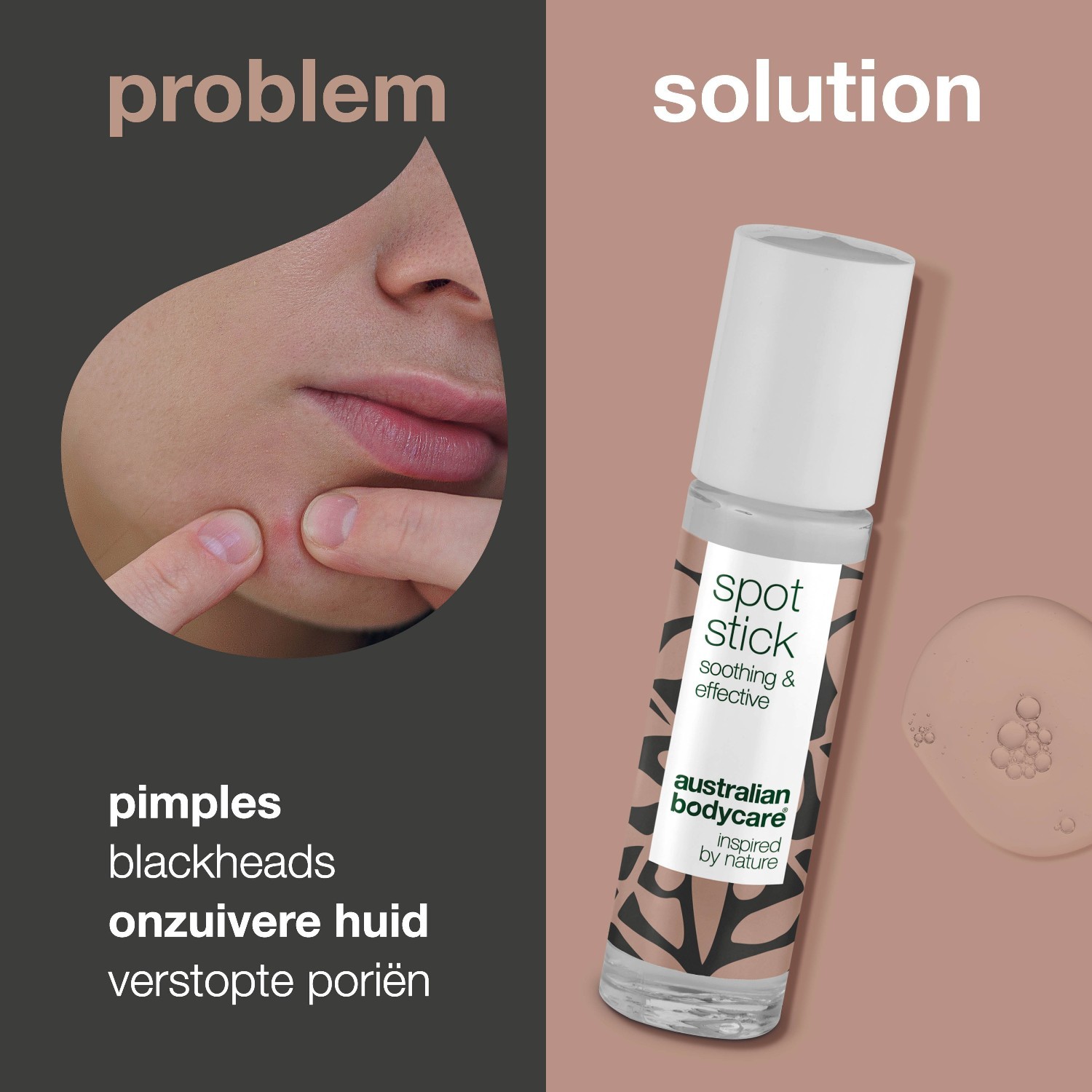 Australian Bodycare stik za tretman protiv nepravilnosti – 9 ml