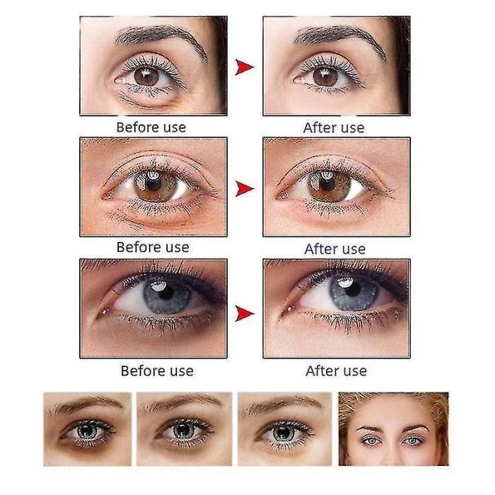 Hydratant visage,Lifting des yeux Autocollants invisibles Rides Poches oculaires Cernes Suppression Anti Vieillissement [B899232596]