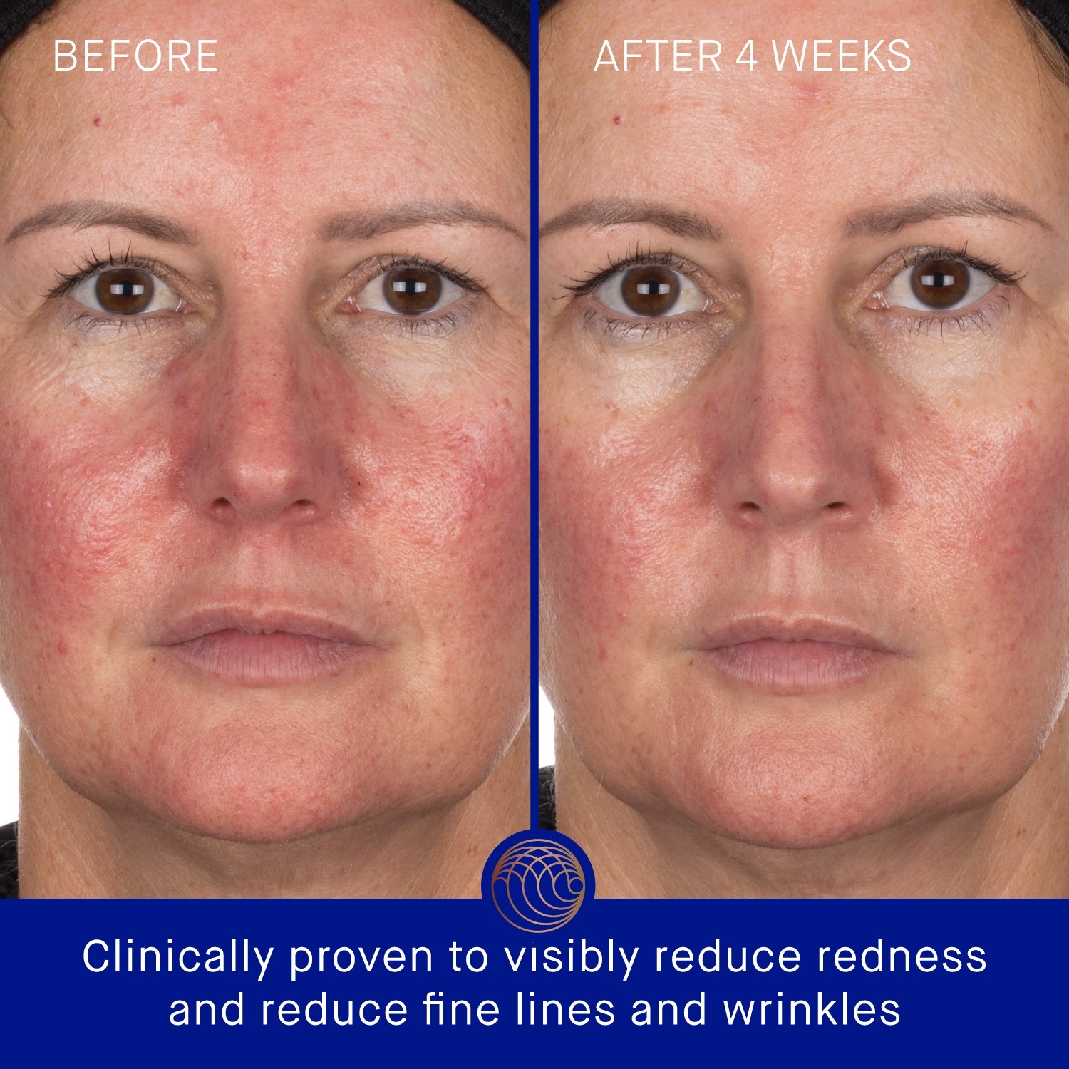 Augustinus Bader Anti-aging Mask Hydrogel Ansiktsmaske Enkel - 30 g