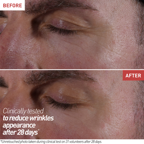 Soins de la peau pour les yeux