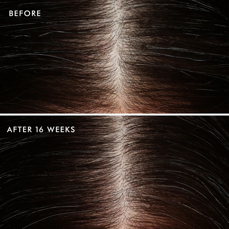Moroccanoil galvas ādas kondicionieris, nomierinošs kondicionieris taukainai galvas ādai