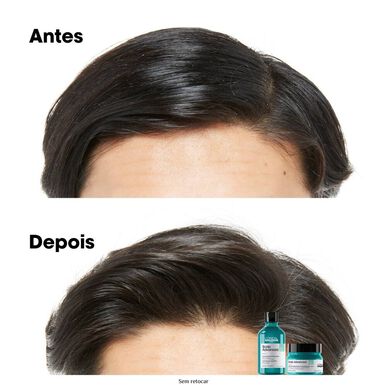 L'Oréal Professionnel Serie Expert Scalp Advanced Anti-Gras Argile Shampoo 2 i 1 beroligende anti-oljemaske 250 ml 250 ml