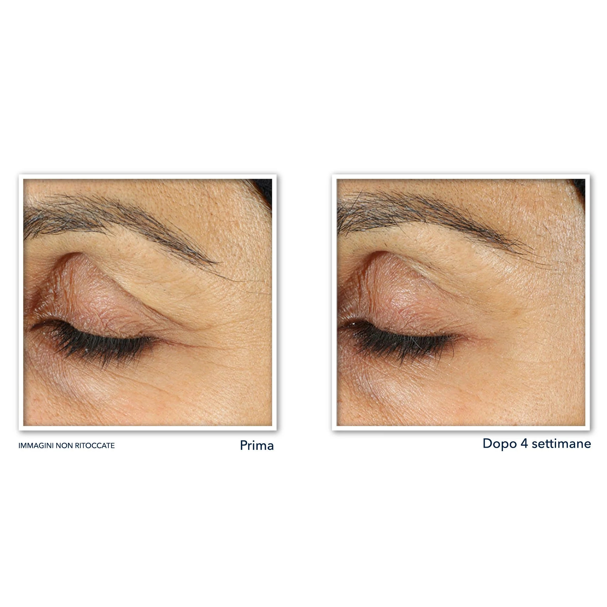 Retinol Correxion Line Smoothing Crema Occhi - Tratt.anti borse e occhiaie, Contorno occhi antirughe