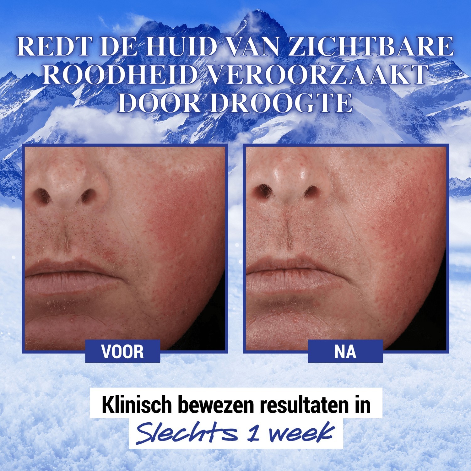 Kiehl's dnevna krema Ultra Facial Advanced Repair zaštitna krema - 50 ml