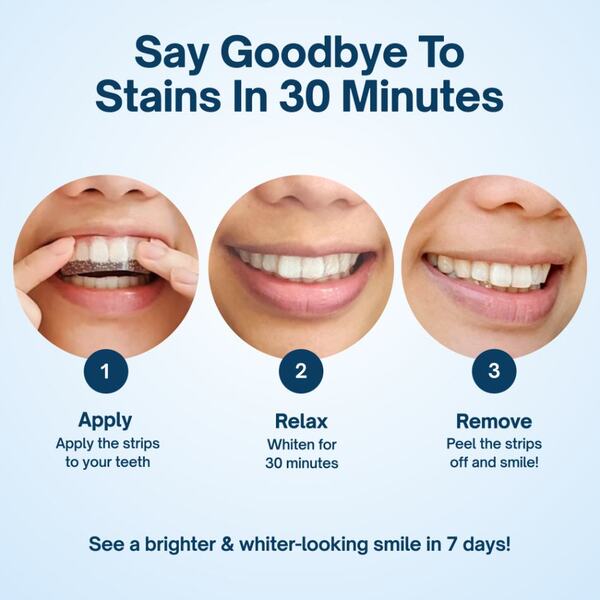 Strisce sbiancanti per denti MySweetSmile PAP - 21 trattamenti