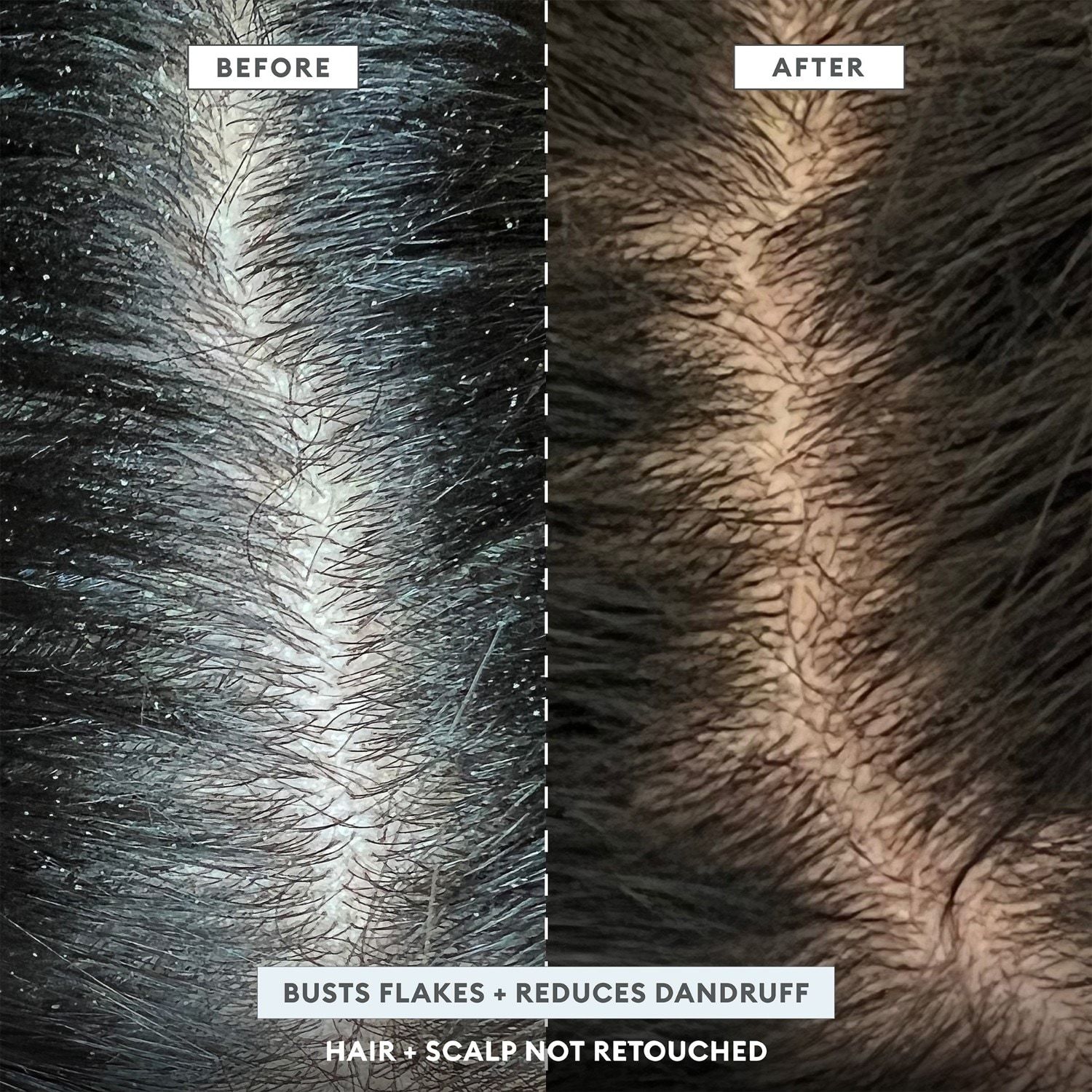 Briogeo Scalp Revival™ MegaStrength+ šampon protiv peruti s aktivnim ugljem + AHA/BHA i 3% salicilne kiseline – 248 ml