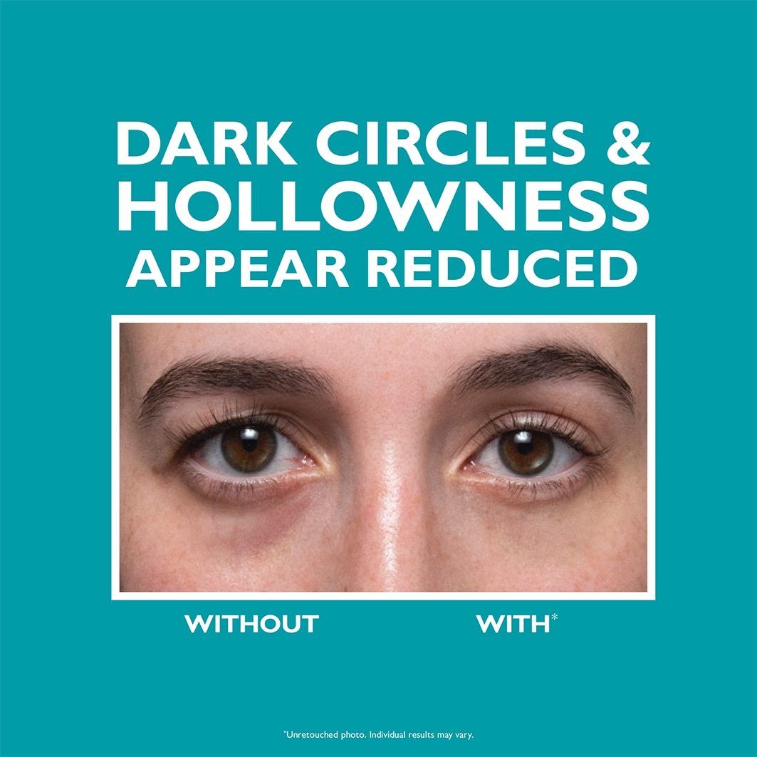 Peter Thomas Roth krema za oči Peptide Skinjection™ krema za popunjavanje i fiksiranje područja oko očiju - 15 ml