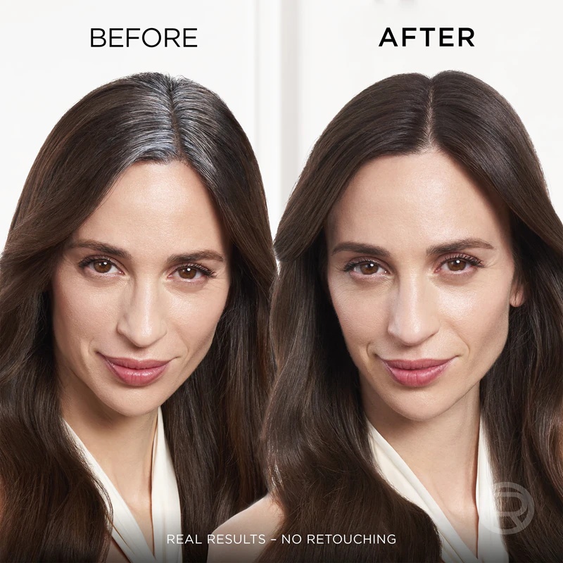 L'Oréal Paris Magic Retouch sprej za takojšnjo retuširanje narastka las