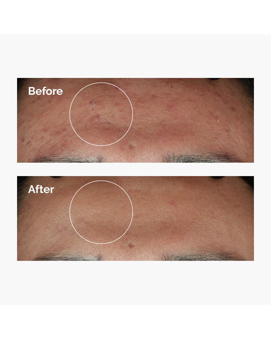 OBIČNI Serum Niacinamid 10% Cink 1%