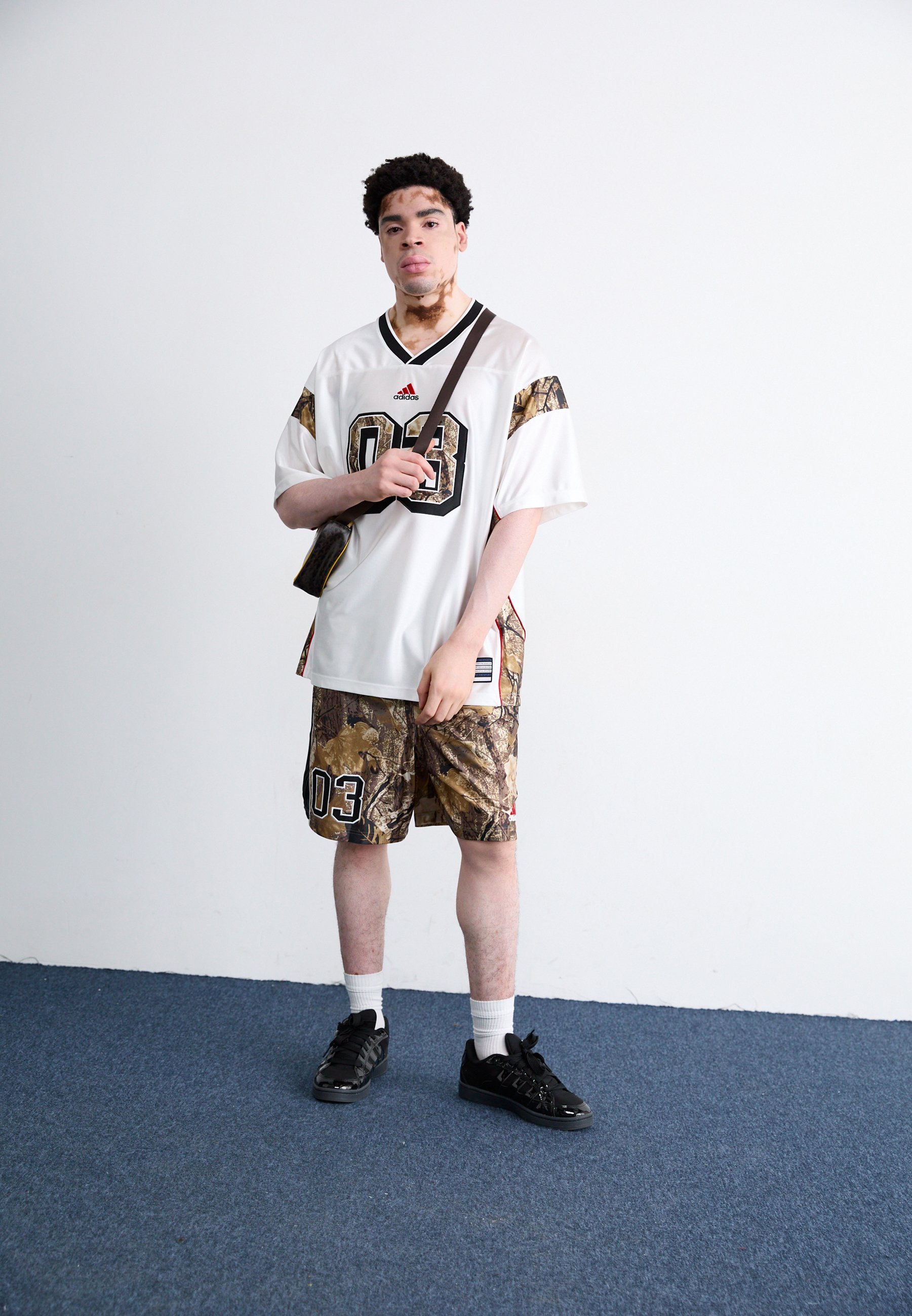 adidas Originals Casual Shorts
