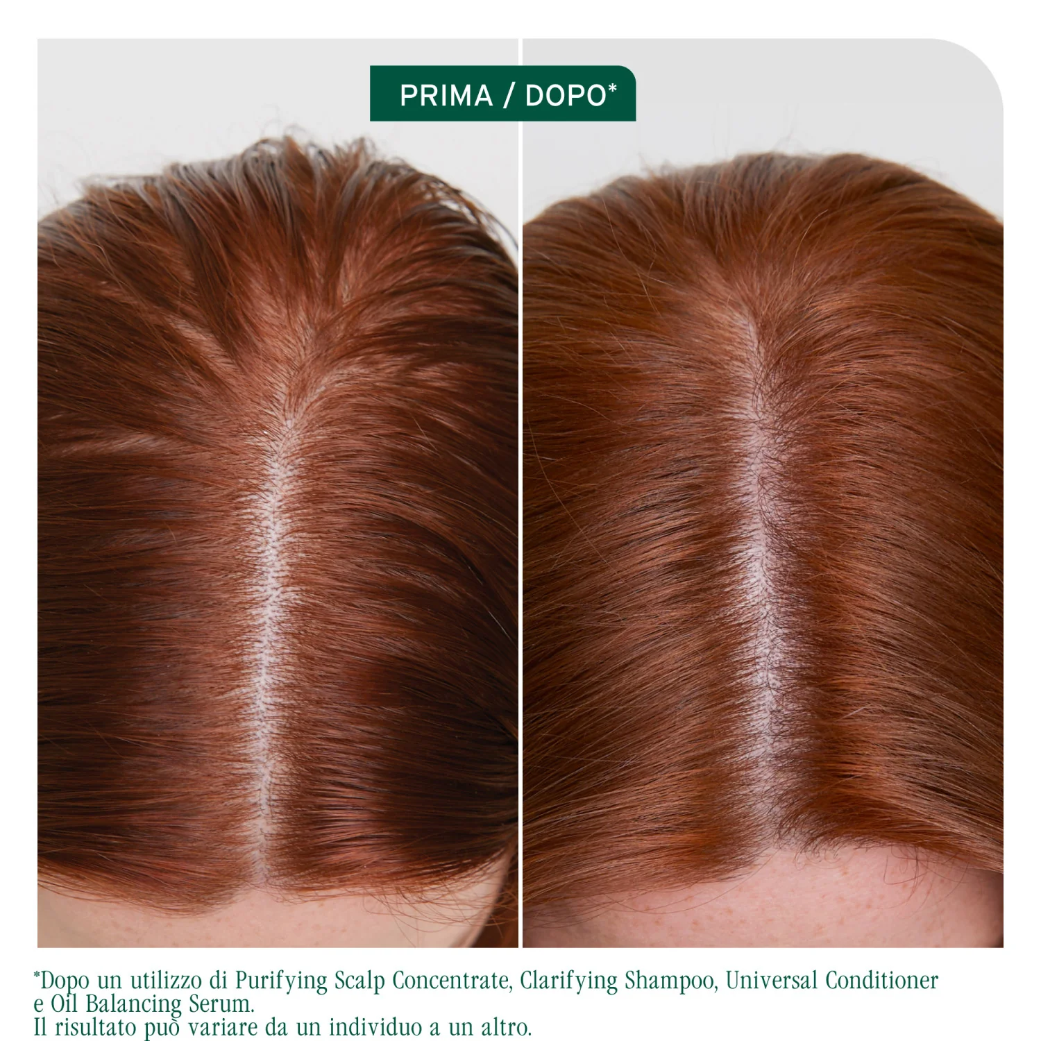 Scalp Sync Oil Balancing Serum - Olio Capelli