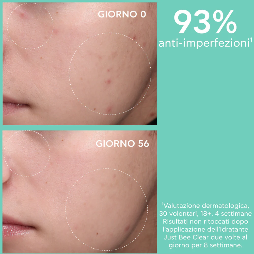 Just Bee Clear Crema Idratante Opacizzante Anti-Imperfezioni - Tratt.viso 24 ore antimperfezioni