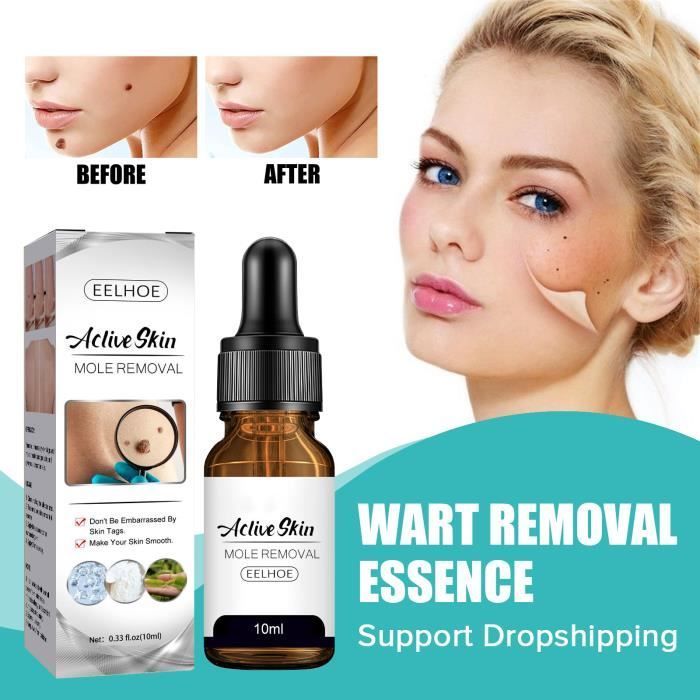 Esencia para disolver verrugas, para eliminar lunares, líquido para eliminar verrugas del cuello y la cara.