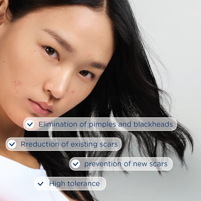 Биодерма Себиум Керато+ гел-крема против несавршености коже склоне акнама