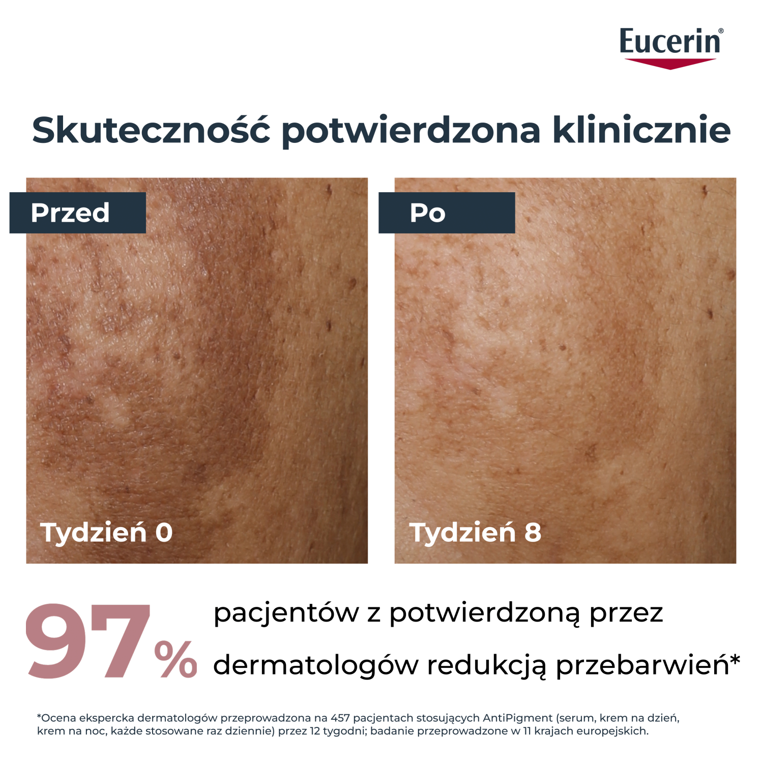 Eucerin Anti-Pigment