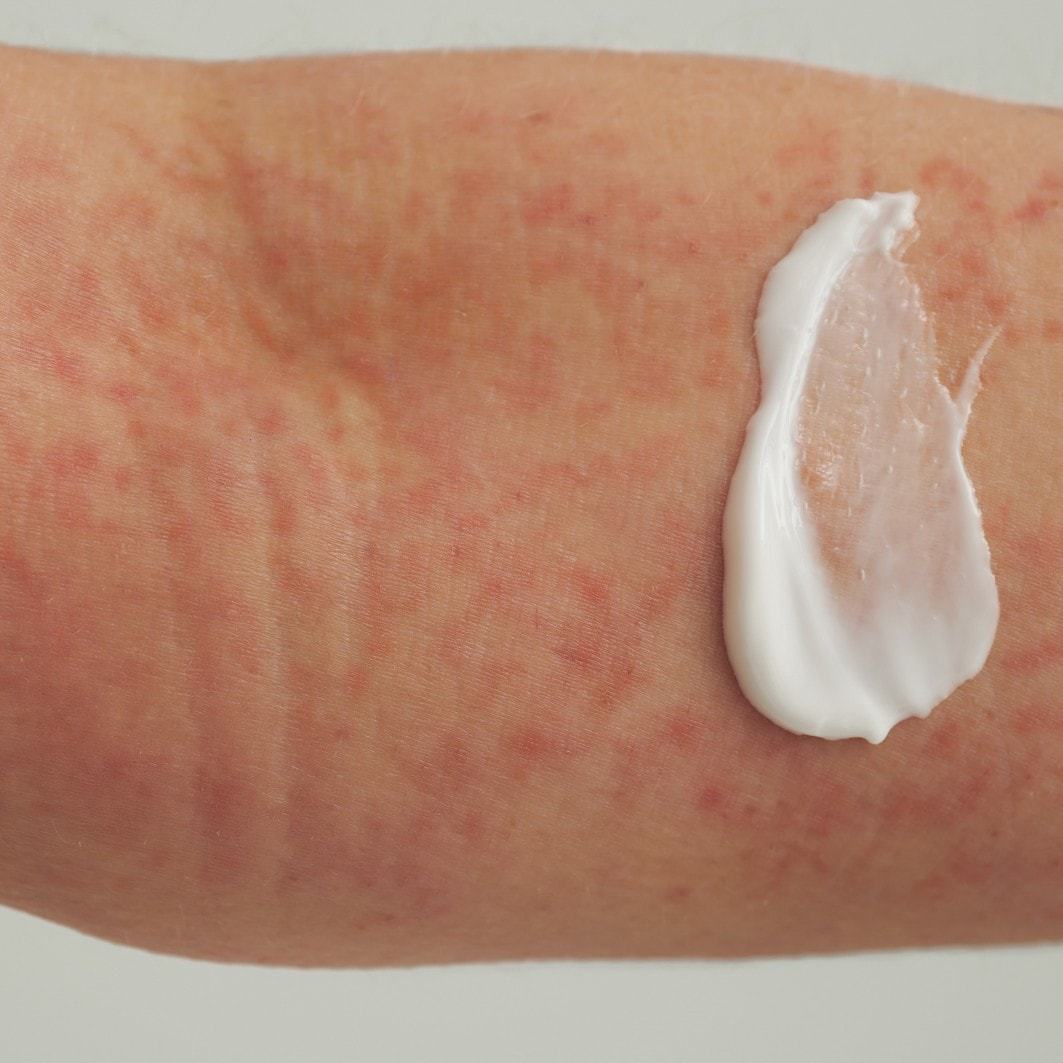 DADO SENS Dermacosmetics krema za tijelo EXTRODERM balzam za kožu - 200 ml