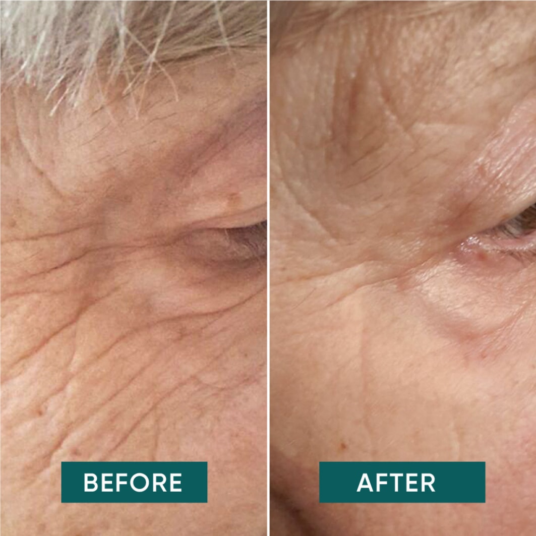 Oogmasker met abrikozenextract en hyaluronzuur voor ogen en slapen – 17 g