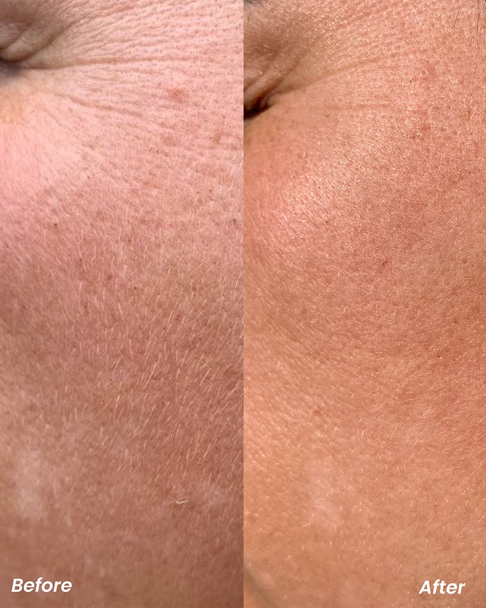 CLAY AND GLOW Ser de noapte cu retinol Ser anti-îmbătrânire