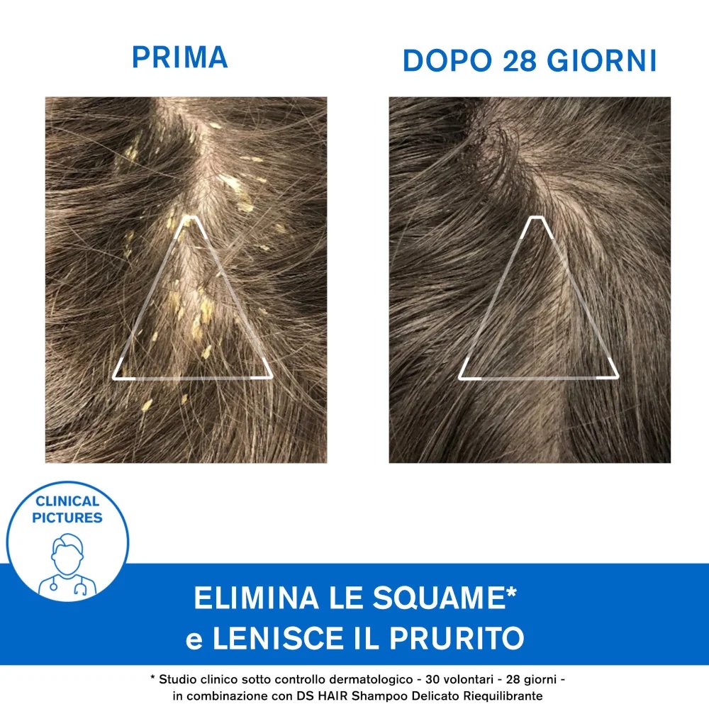 URIAGE Uriage DS Haar Sh Keratoridut milde exfoliërende crème