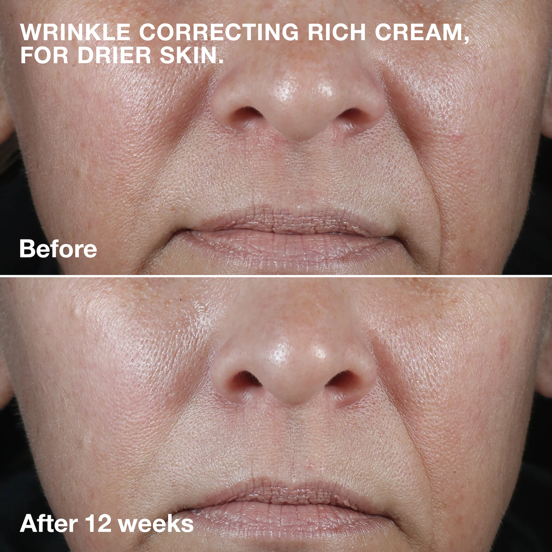 Smart Clinical Repair ránctalanító arckrém gazdagon 50 ml - Clinique
