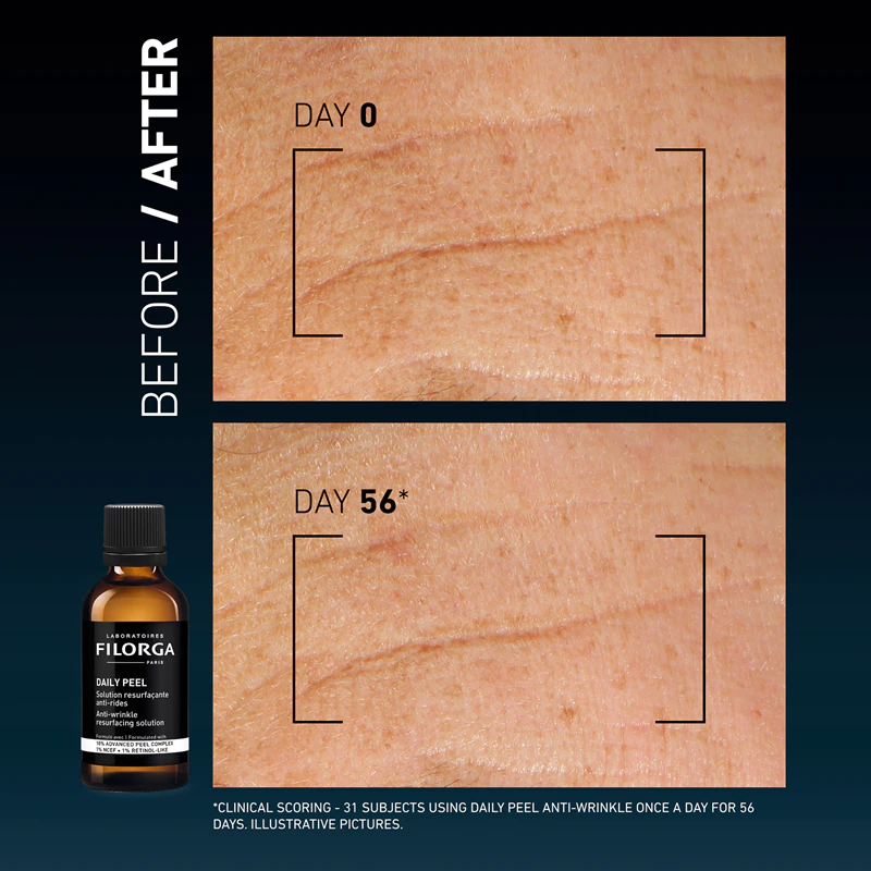 FILORGA DAILY PEEL ANTI-WRINKLE peeling proti vráskam