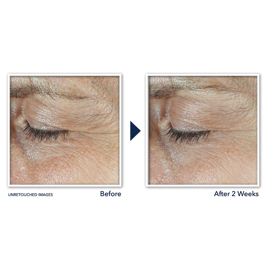 RoC krema za oči Derm Correxion® dvostruka krema za oči - 20 ml