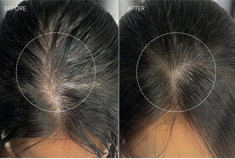 FOREO LUNA™ Sérum de Peptídeos Duplos - Sérum nutritivo para o couro cabeludo