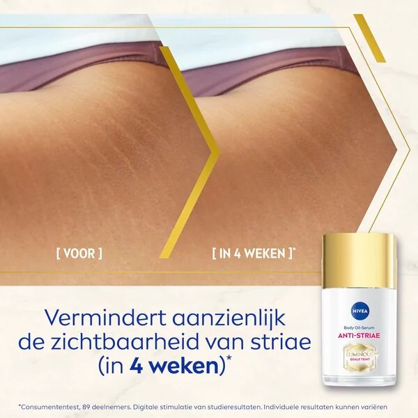 NIVEA Luminous630 oljni serum za telo proti strijam/strijam<br>100 ml