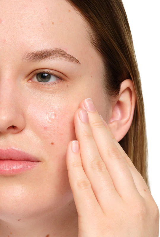 sérum facial The Ordinary com ácido salicílico a 2% (solução anidra) uniformiza o tom da pele.