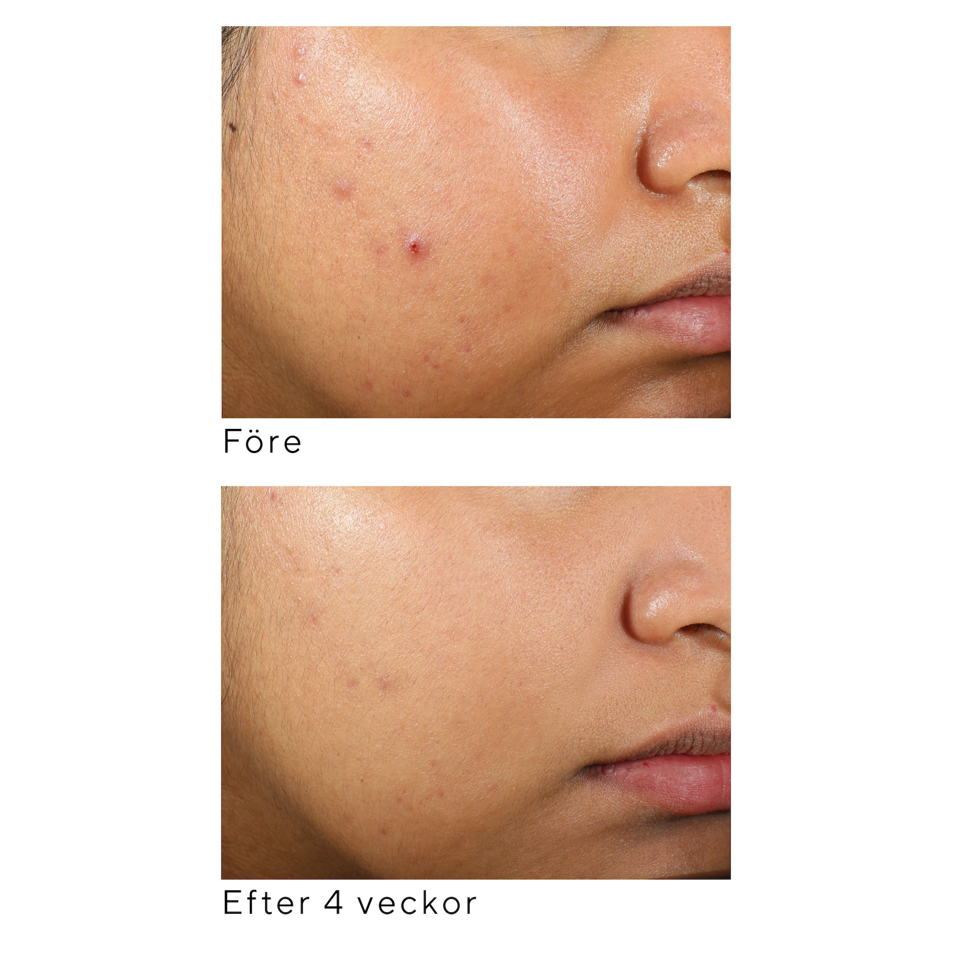Ser facial cu gel de apă clarificant 60 ml - Murad