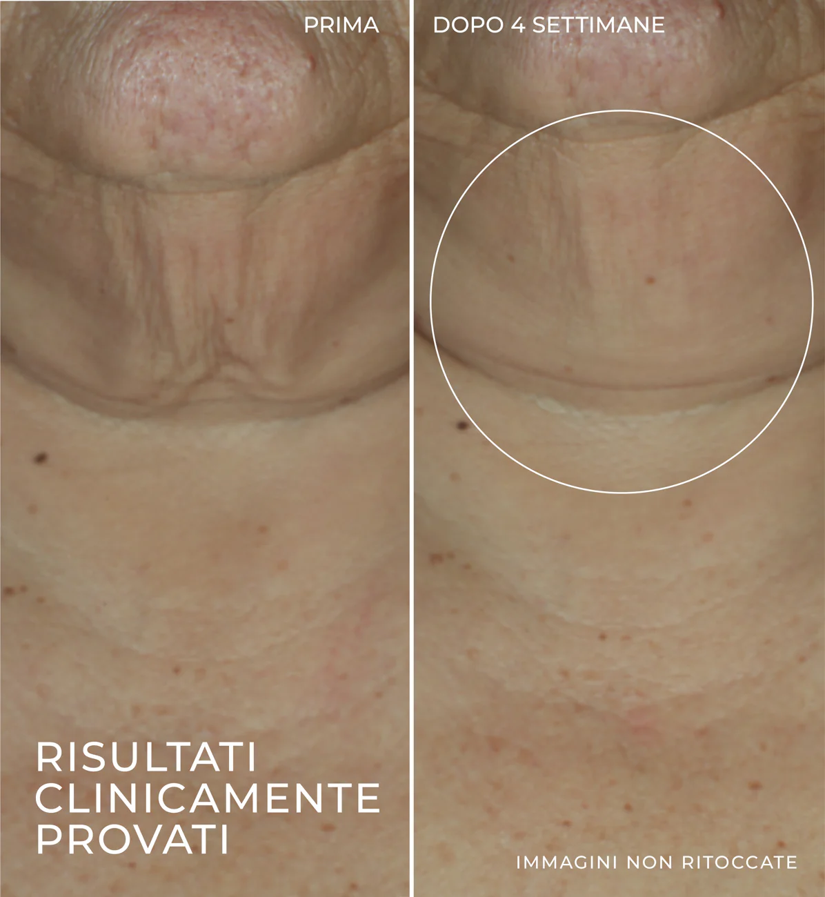 Derm Correxion Firming Serum Stick - Stick lifting, Siero viso lifting