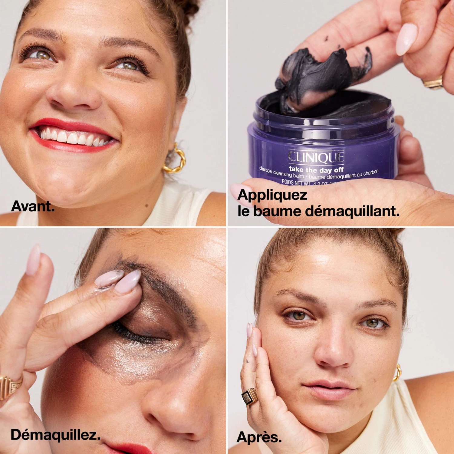 Clinique Charbon